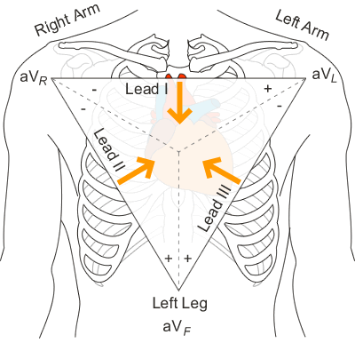 Einthoven’s triangle - Diagram showing the line of site of the bipolar leads