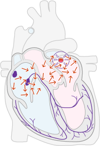 Disorganised electrical activity within the Atria