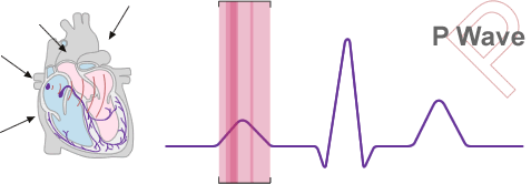 Diagram of the P wave section of the sinus wave
