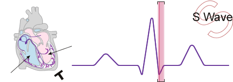 Diagram of the S wave section of the sinus wave
