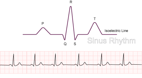 Diagram of theP,QRS & T Wave