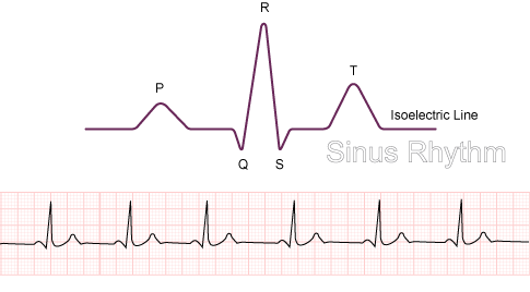 Sinus : définition 