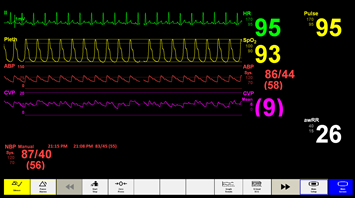 Monitor observations
