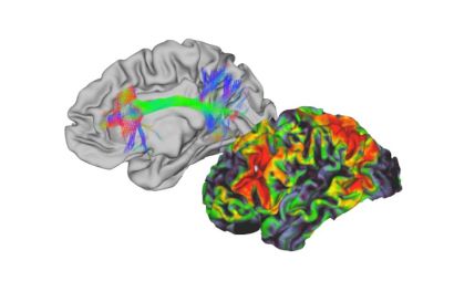 New MRI technologies