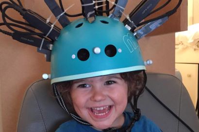 Bike helmet style brain scanner